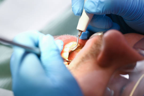 Best Pediatric Emergency Dentist in Juarez, TX